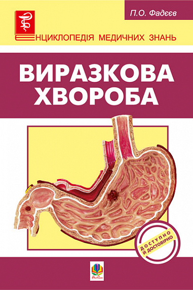 Виразкова хвороба  Фадєєв П.О.